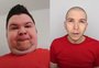 Quem é Nikocado Avocado, youtuber que surpreendeu seguidores ao revelar processo de emagrecimento e a perda de 113 quilos