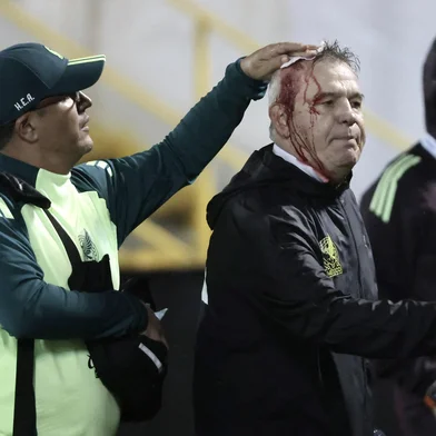 Mexico's coach, Javier Aguirre (R), is helped by an assistant after being injured in the head when he was hit by an object thrown from the bleachers at the end of the National League of Concacaf quarterfinal first leg match between Honduras and Mexico at the Francisco Morazan stadium in San Pedro Sula, Honduras, on November 15, 2024. (Photo by Jhony MAGALLANES / AFP)<!-- NICAID(15915156) -->