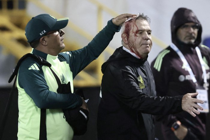 JHONY MAGALLANES / AFP