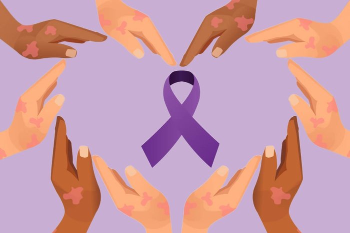 chuteye / Shutterstock | Portal EdiCase