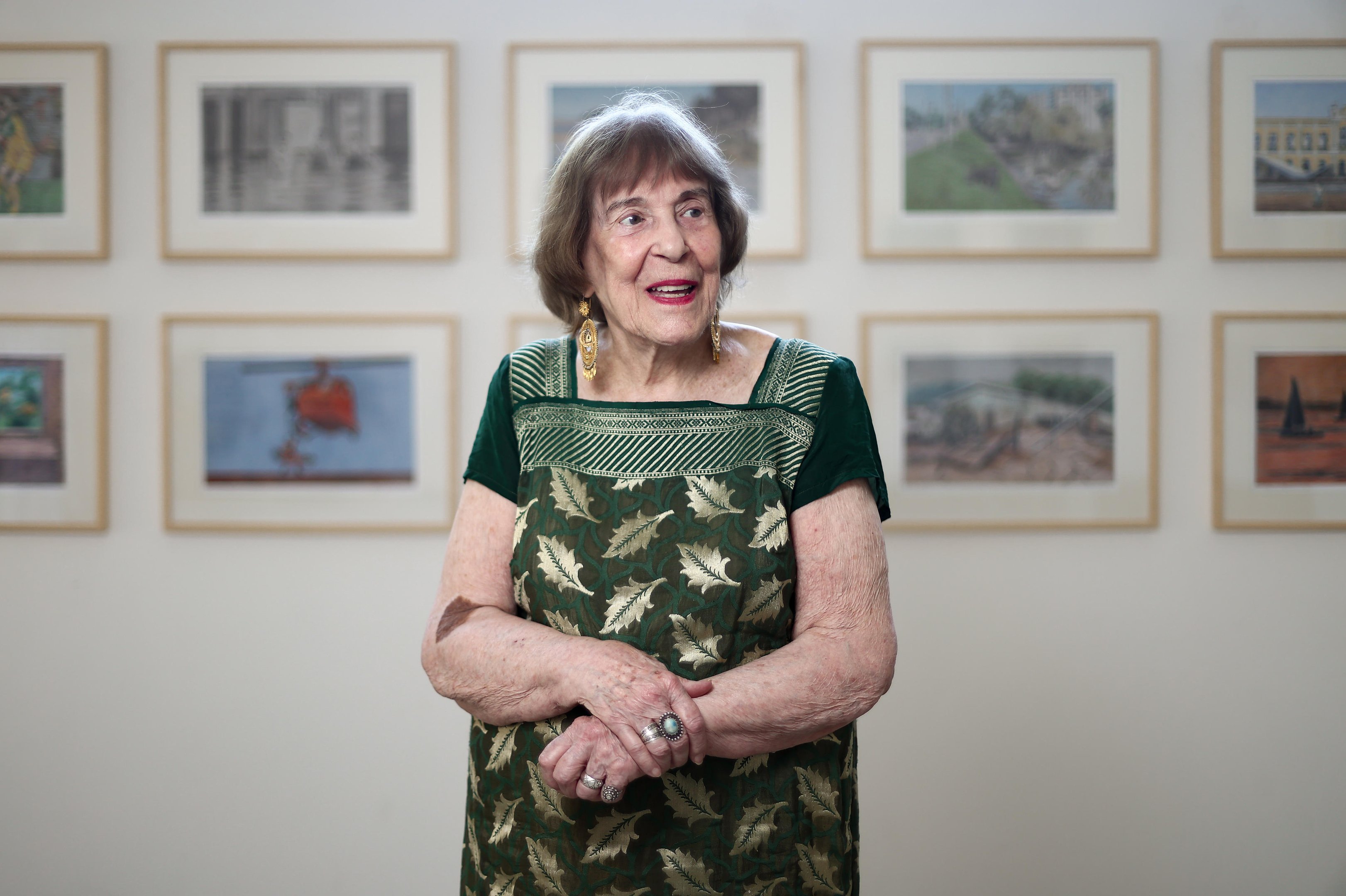 Artista ga&uacute;cha Zoravia Bettiol recupera-se de cirurgia