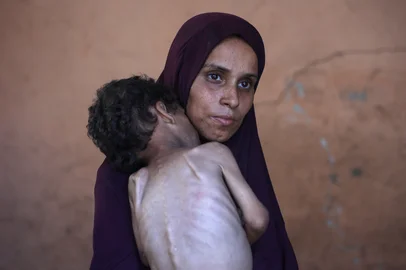 Naeema, a 30-year-old Palestinian mother, carries her malnourished 2-year-old son Yazan as they stand in their damaged home in the Al-Shati refugee camp, west of Gaza City, on July 23, 2025. More than 100 aid organisations and human rights groups warned on Wednesday that "mass starvation" was spreading in Gaza, as the United States said its top envoy was heading to Europe for talks on a possible ceasefire and aid corridor. (Photo by Omar AL-QATTAA / AFP)Editoria: WARLocal: Gaza CityIndexador: OMAR AL-QATTAASecao: armed conflictFonte: AFPFotógrafo: STR<!-- NICAID(16086375) -->