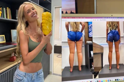 Yasmin Brunet mostra resultados do tratamento de lipedema<!-- NICAID(15938509) -->