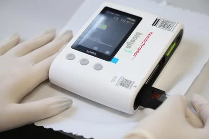 Com mais de 5 mil casos de dengue confirmados em 2025, a prefeitura de Porto Alegre vai ser a primeira do Estado a usar um hemoglobinômetro para acelerar a triagem de casos graves entre os infectados pelo vírus. O equipamento começará a ser utilizado neste sábado (26), na Unidade de Saúde Passo das Pedras I (avenida Gomes de Carvalho, 510).<!-- NICAID(16024709) -->