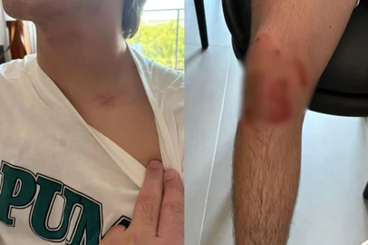 Adolescente de 16 anos agredido por gerente de banco em Pelotas<!-- NICAID(16187528) -->