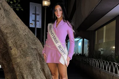 Miss Universo terá primeira candidata com vitiligo<!-- NICAID(15892109) -->