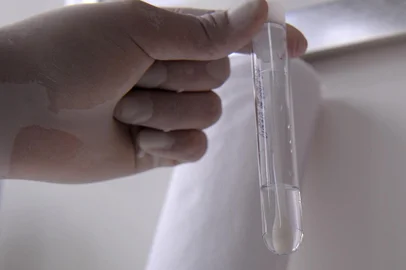 CAXIAS DO SUL, RS, BRASIL, 04/09/2020 - Laboratório Alfa faz coleta para teste de covid 19. Além de coleta de sangue, o laboratório também faz teste PCR, feito por meio de um cotonete introduzido na narina. (Marcelo Casagrande/Agência RBS)<!-- NICAID(14587967) -->
