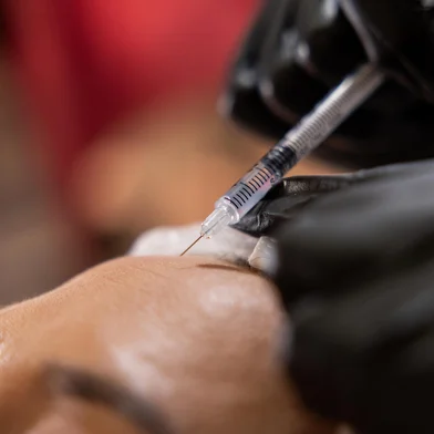 PORTO ALEGRE, RS, BRASIL - 25-06-2025:  No inverno, a pele tende a ficar mais ressecada e sensível, tornando alguns procedimentos estéticos mais indicados. É a estação ideal para fazer peelings, laser, entre outros.<!-- NICAID(16067255) -->