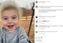 Menino dos EUA com "síndrome do cabelo impenteável" vira fenômeno na internet