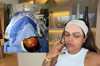 Camila Loures retira veia saltada da testa<!-- NICAID(16261588) -->