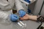 enfermeia com jaleco branco e luva azul segura a mão de uma mulher e alfineta a agulha do teste para hepatites<!-- NICAID(14845842) -->