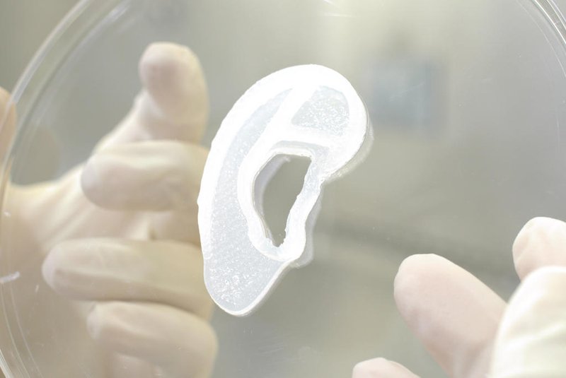 Primeiro transplante de orelha utilizando uma tecnologia de bioimpressão em 3D. Foto: 3DBio / Divulgação<!-- NICAID(15113192) -->