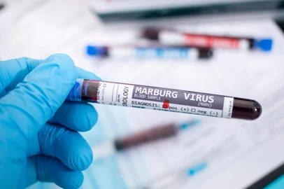 Blood samples with infected virus *A PEDIDO DE FILIPE PIMENTEL* Fictional Blood samples with infected marburg virus, with stethoscope, mask and syringe and other stuff. - Foto: Mauro Rodrigues/stock.adobe.comIndexador: MAURO RODRIGUESFonte: 332931596<!-- NICAID(15151494) -->
