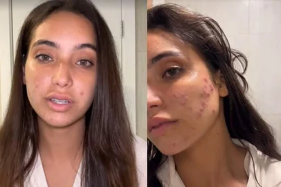 Vanessa Lopes<!-- NICAID(15850054) -->