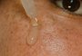 Ácido glicólico: para que serve o ativo que ajuda a renovar a pele e ganhou espaço no skincare