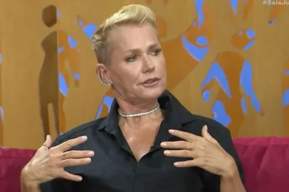 Xuxa Meneghel revela procedimentos estétic.os sem sua autorização: "Me encheu de fibrose"<!-- NICAID(15371611) -->