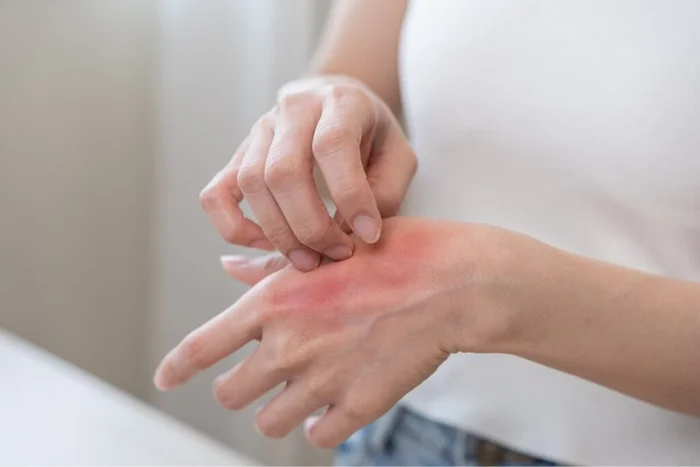 Kmpzzz / Shutterstock | Portal EdiCase Kmpzzz / Shutterstock | Portal EdiCase