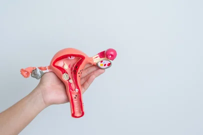 Woman holding Uterus and Ovaries model. Ovarian and Cervical cancer, Cervix disorder, Endometriosis, Hysterectomy, Uterine fibroids, Reproductive system and Pregnancy conceptFonte: 566878964<!-- NICAID(15697934) -->
