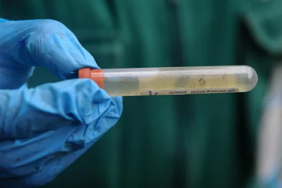 CAXIAS DO SUL, RS, BRASIL, 04/04/2024. Ação de fiscalização da Secretaria Municipal da Saúde, no bairro Reolon, em áreas com possíveis focos de dengue. (Bruno Todeschini/Agência RBS)Indexador: BTK<!-- NICAID(15725655) -->