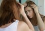 Minoxidil para calvície feminina: tratamento popular entre os homens também é eficaz para mulheres