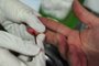 PORTO ALGRE,  RS-, BRASIL, 01/07/2012, 14:00HS -  Teste rápido para o HIV. Secreteria de saúde de porto Alegre faz o teste em uma campanha realizada na Redenção. O teste consiste em fazer uma picada no dedo para retirar uma amostra de sangue.  (FOTO: FERNANDO GOMES / ZERO HORA)<!-- NICAID(8375103) -->