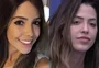 Laís Caldas, do "BBB 22", abre o jogo sobre procedimentos estéticos