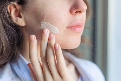 Creme facial - Foto: Маргарита Манухо/stock.adobe.comFonte: 332864081<!-- NICAID(15728628) -->