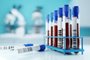 Sangue para estudo em laboratório<!-- NICAID(15258461) -->