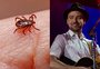 Doença de Lyme, quadro de Justin Timberlake, é transmitida por carrapato e tem sintomas iniciais semelhantes aos da gripe