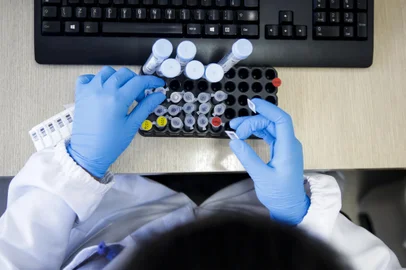 PORTO ALEGRE, RS, BRASIL, 26-01-2022: Chegada de material para analise. Laboratorio de Biologia Molecular da Santa Casa realiza testes PCR. O professor de Infectologia da UFCSPA Alessandro Pasqualotto coordena o laboratorio. (Foto: Mateus Bruxel / Agencia RBS)Indexador: Mateus Bruxel<!-- NICAID(14999271) -->