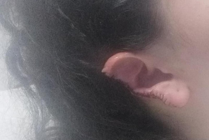 Mulher teve orelha arrancada a mordida pelo ex-companheiro em Porto Alegre<!-- NICAID(15662204) -->