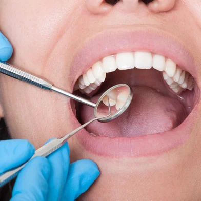 Closeup of dentist tools and mouth open with beautiful teeth<!-- NICAID(16118170) -->