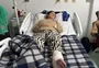 Falta de anestesistas afeta realização de cirurgias em hospital de Sapucaia do Sul