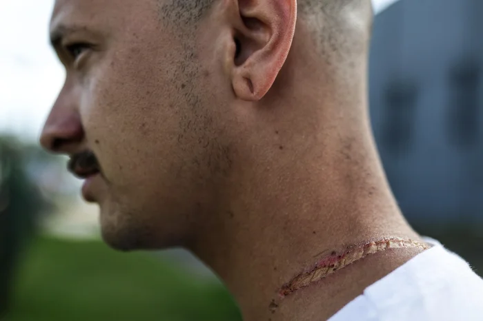 Renan Mattos / Agencia RBS