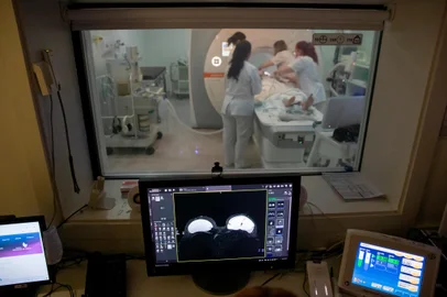 Os avanços no tratamento do câncer de mama, como o uso da inteligência artificial. No Moinhos de Vento, já existe uma aceleração da ressonância magnética por meio da IA.<!-- NICAID(15896140) -->