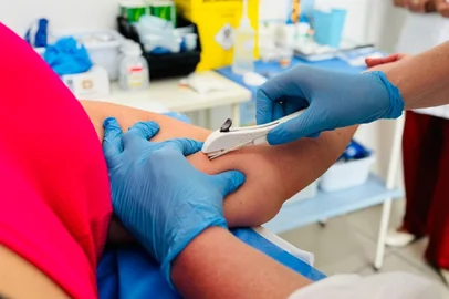 Gisele Nozari / Divulgação Caxias do Sul recebe mais 1,5 mil contraceptivos Implanon<!-- NICAID(16367527) -->