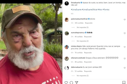 Nesta quinta-feira (4), Lima Duarte apareceu em suas redes sociais com os dois olhos roxos, uma ferida na testa e lábios machucados. No seu Instagram, o ator de 91 anos escreveu "apesar do susto, eu estou bem. Levei um tombo, mas não caí!".<!-- NICAID(14932711) -->