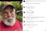 Lima Duarte surge com o rosto machucado nas redes e revela que sofreu um tombo