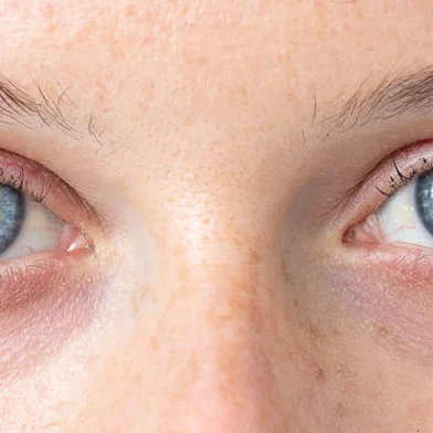 Blue eye of young caucasian womanFonte: 203678082<!-- NICAID(15661652) -->