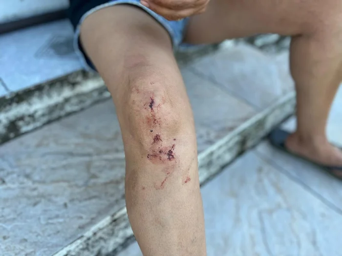 Frederico Feijó / Agencia RBS