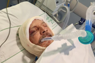 Entregador fica gravemente ferido após ser atacado por cinco pitbulls em Minas do Leão<!-- NICAID(16120215) -->