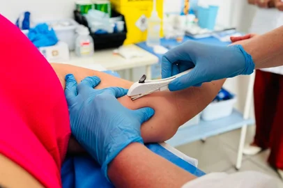 Mutirão do Implanon<!-- NICAID(16250106) -->