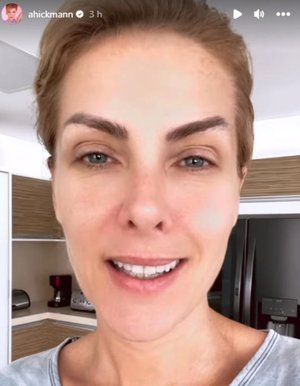 @ahickmann Instagram / Reprodução