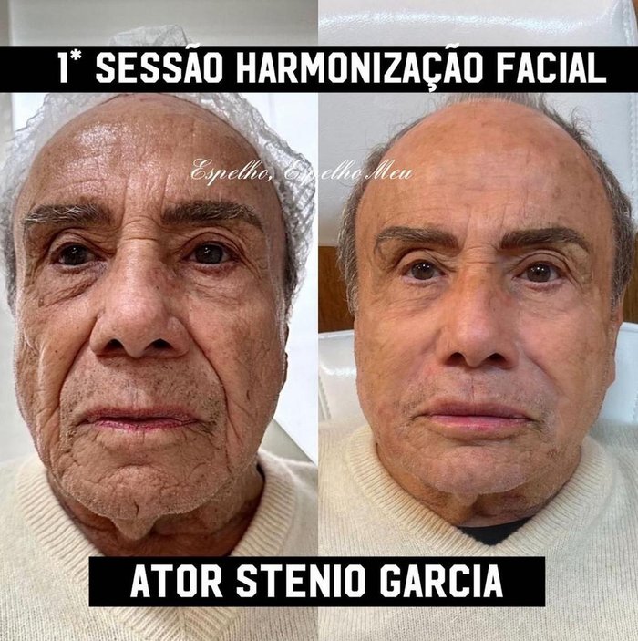 @espelhoespelhomeutatui Instagram / Reprodução