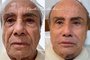 Stenio Garcia faz harmonização facial<!-- NICAID(15455552) -->