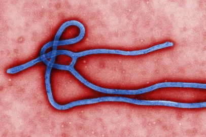 Vírus do Ebola<!-- NICAID(14796671) -->