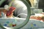 CTI Neonatal do hospital do Circulo Fotos para materia sobre bebes prematuros Na foto Vithor Rafael da Rosa 33 semanas cti,neonatal,vithor rafael da rosa,bebê,prematuro,hospital