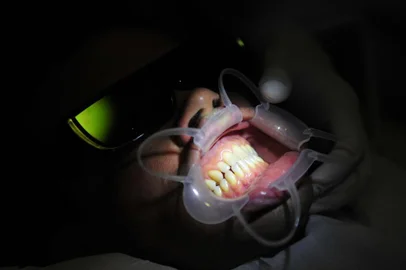 Tadeu Vilani Porto Alegre RS Data 26 06 2012 Avancos na Odontologia Marcelo com o paciente Marcelo Guimaraes da Silva usa oculos 3d para ver precisamente o que esta sendo feito avanços na Odontologia,odontologia,dentes,marcelo,óculos 3d