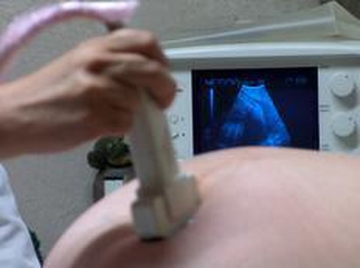 perguntas sobre diabetes gestacional y perguntas sobre diabetes gestacional y