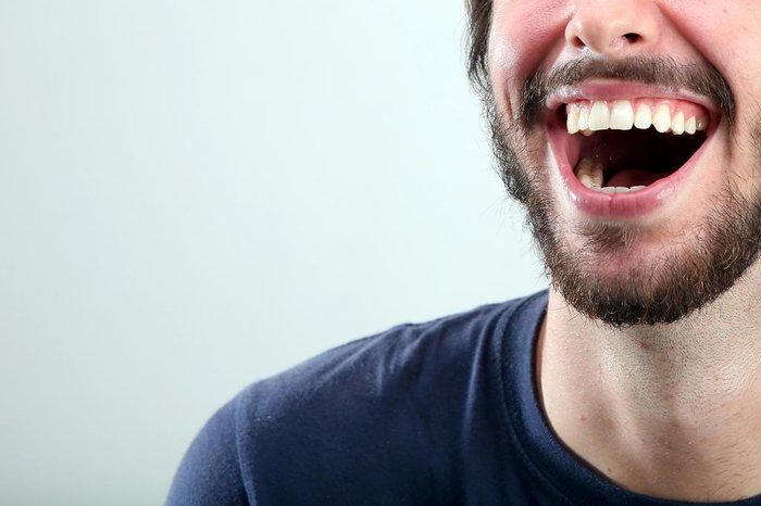 Bruno Alencastro / Agencia RBS